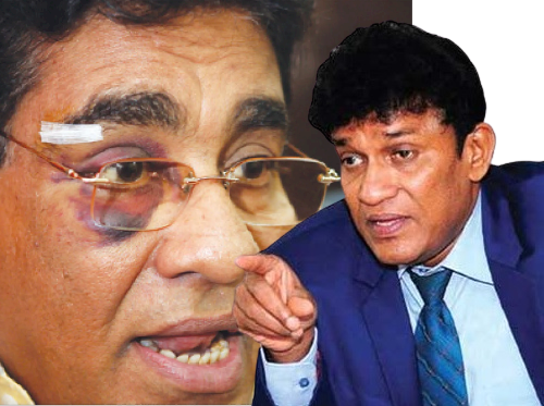 தமிழரின் தலை பற்றி பேசும் மேர்வினுக்கு மண்டை சுகமில்லா நோயுள்ளது – மனோ கணேசன் எம்பி