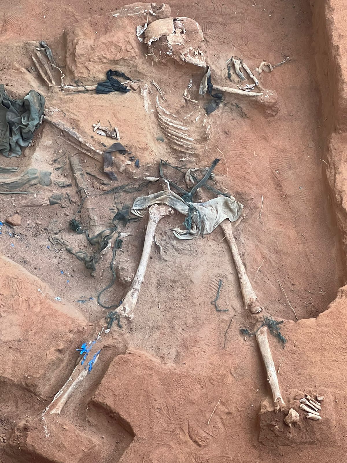 கொக்குத்தொடுவாய் மனிதப் புதைகுழியில் இன்று 3 எலும்புக்கூட்டுத் தொகுதிகள் மீட்பு!  – விடுதலைப்புலிகளின் சைனட் குப்பியும் இரண்டு இலக்கத் தகடுகளும் சிக்கின.