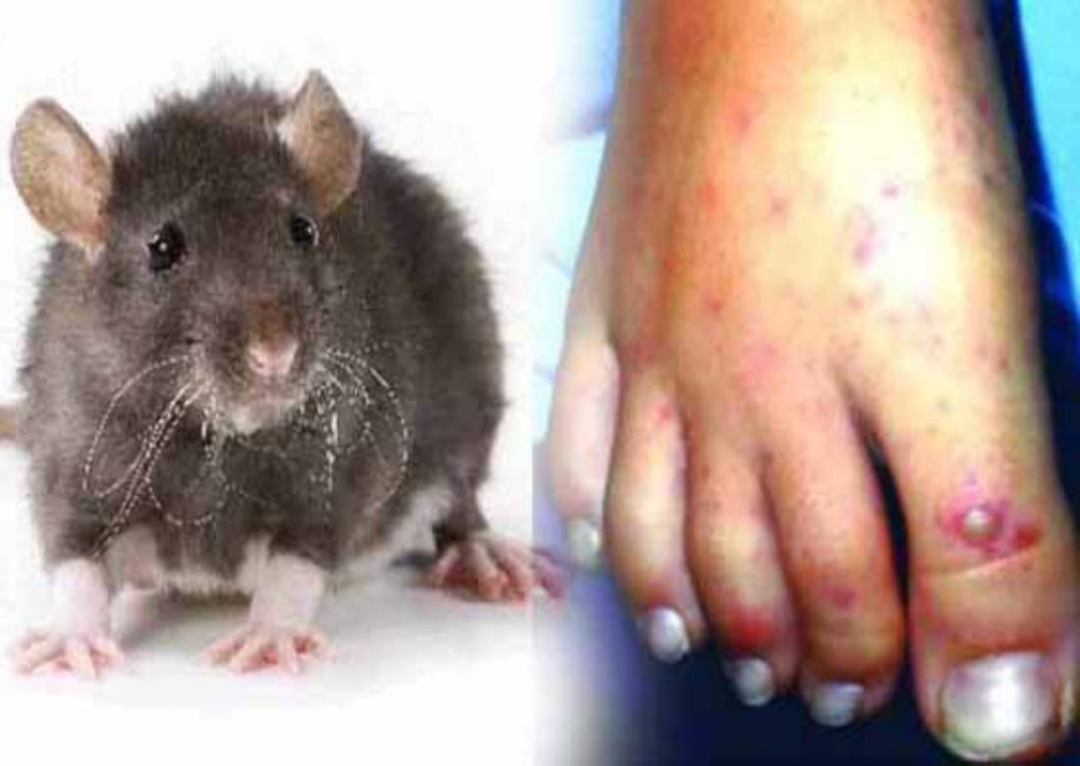 வவுனியாவில் எலிக்காய்ச்சலால் இளைஞர் ஒருவர் பரிதாப மரணம்.