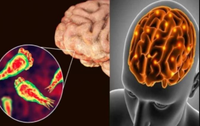 மூளையை தின்னும் அமீபா; தமிழக அரசு முக்கிய அறிவிப்பு!