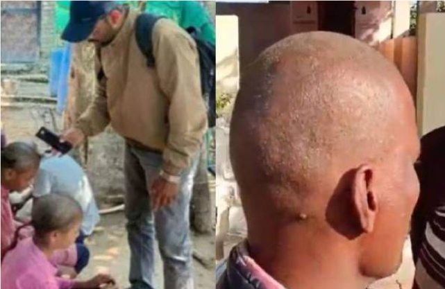 இந்திய கிராமம் ஒன்றில் உள்ள மக்களுக்கு திடீரென முடி உதிர்தல் ஏற்பட்டு வழுக்கையாவதால் மக்கள் அச்சம்!