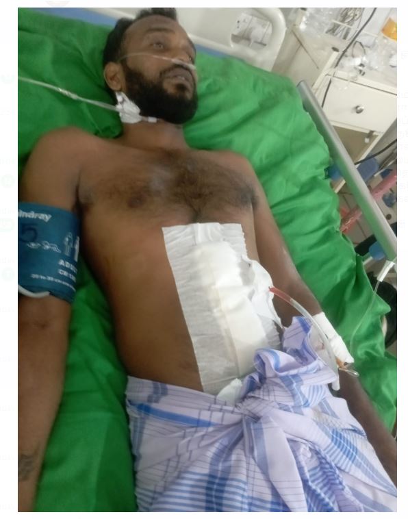 வவுனியா சிறையில் சிறைக் காலர்கள் யாழ். கைதி மீது மோசமான தாக்குதல்!