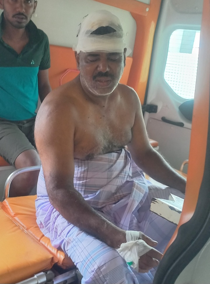 அச்சுவேலியில் அதிகாலை கடை உரிமையாளர் மீது இனந்தெரியாத கும்பல் கொலைவெறித் தாக்குதல்!