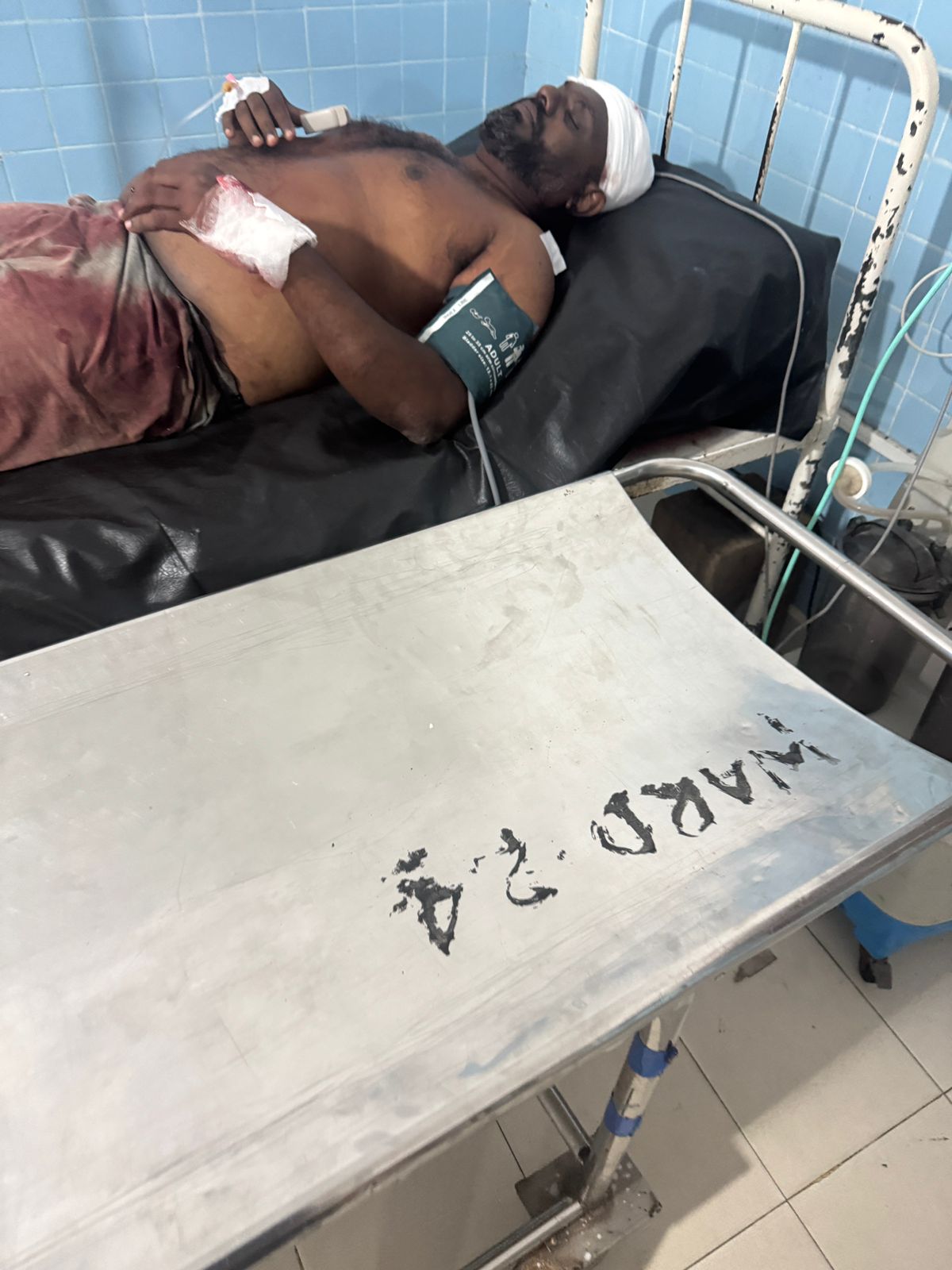 ஜேர்மனில் இருந்து விடுமுறைக்கு யாழ். வந்தவர் இளைஞர் ஒருவர் மீது மூர்க்கத்தனமாகத் தாக்குதல்.