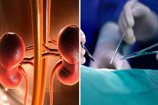 சிறுநீரக விற்பனை முறைகேடு: ஏழைப் பெண்களை குறிவைத்து மோசடி – அதிர்ச்சித் தகவல்கள்!