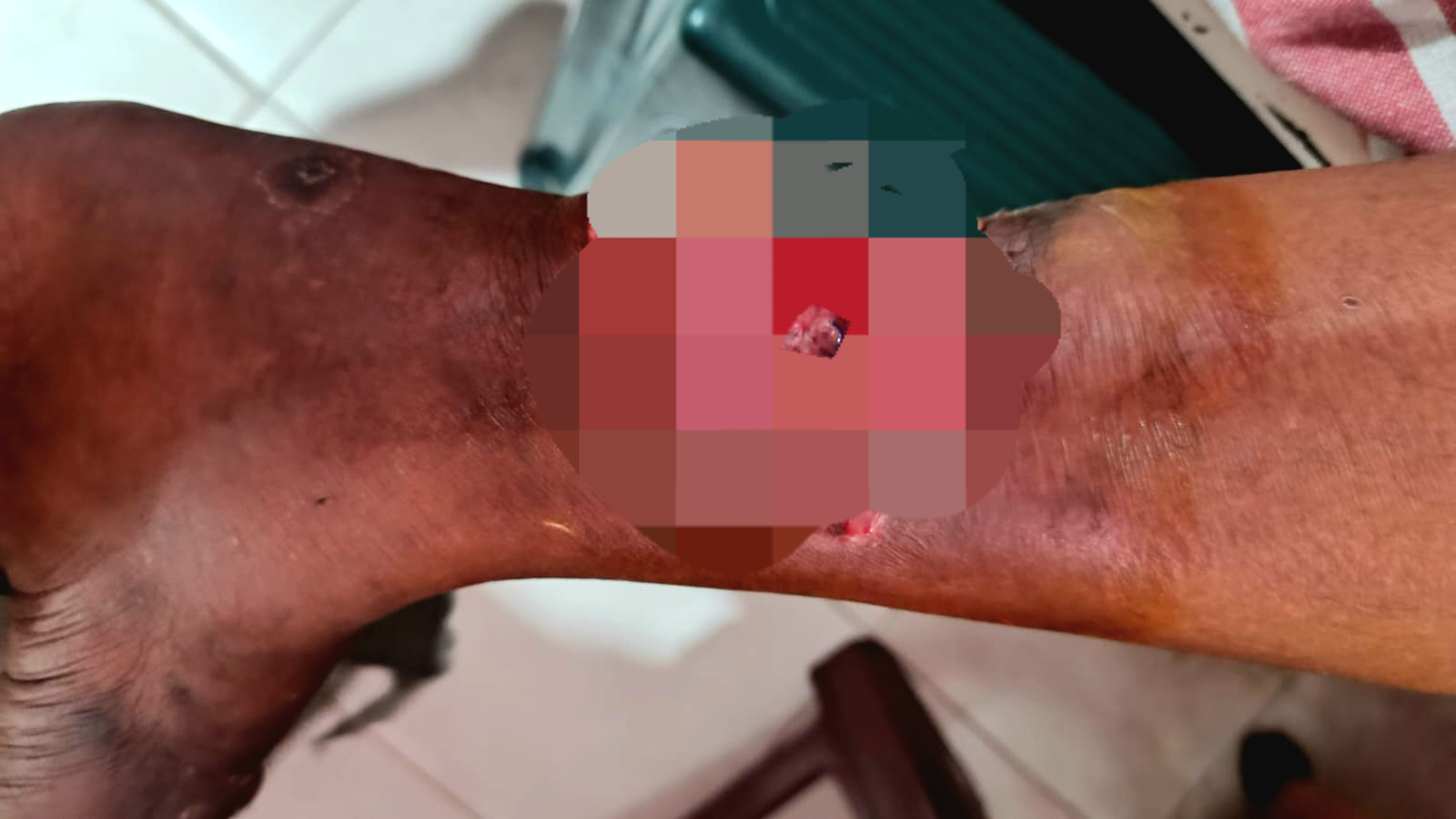 வந்தாறுமூலையில் குரங்கு கடித்ததில் 6 பெண்கள் காயம்.