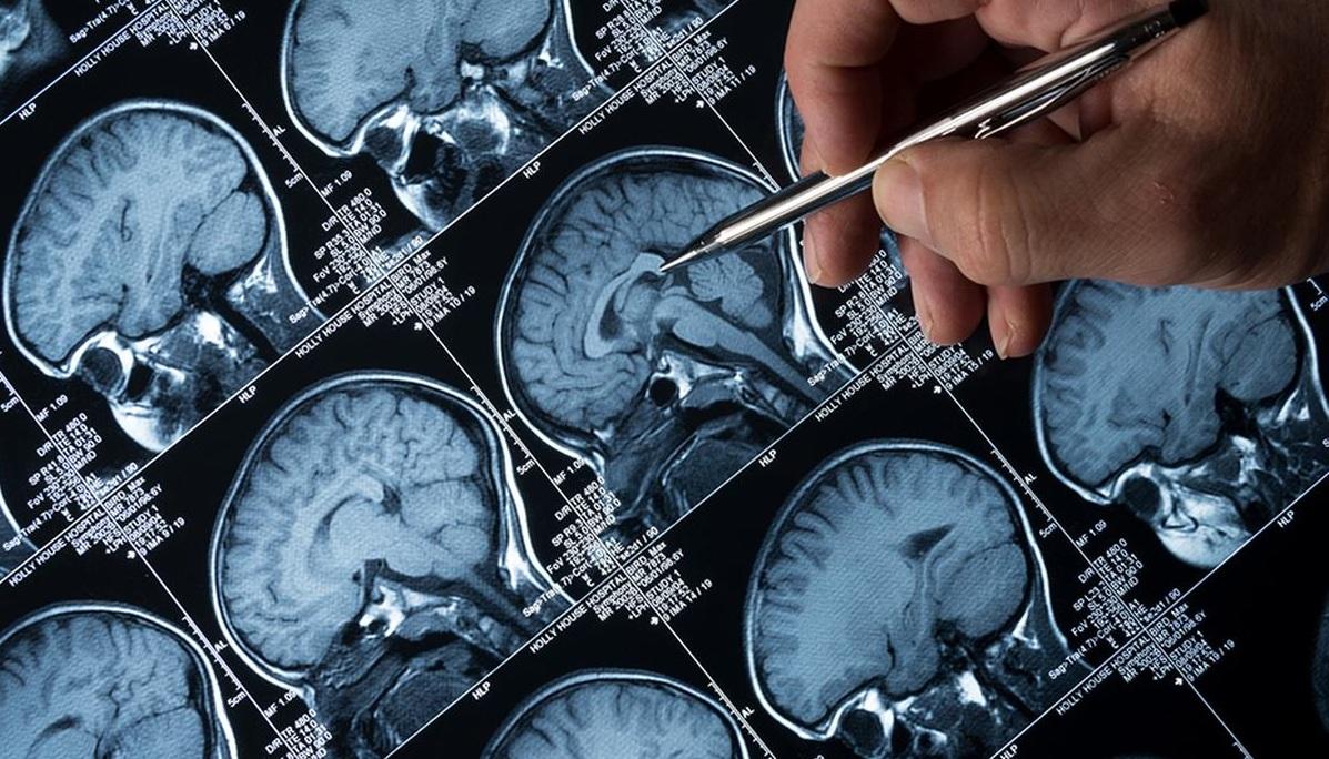 கோழிக்கோட்டில் அரியவகை அமீபா பாதிப்பு: 9 வயது சிறுமி பலி