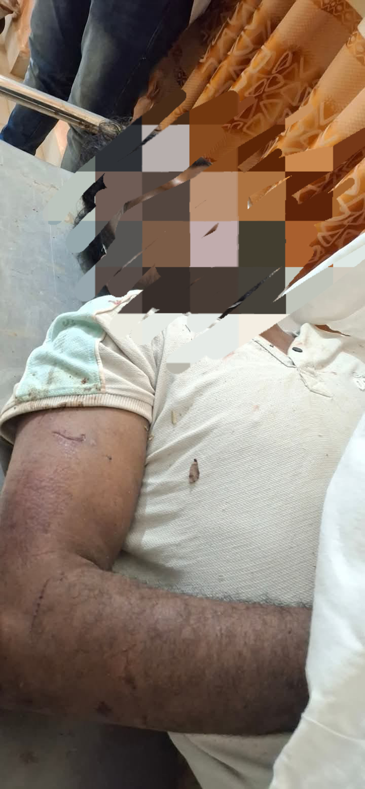 யானை தாக்கி ஒருவர் மரணம்  – வவுனியாவில் துயரம்.