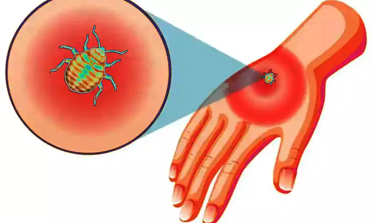 தெலங்கானாவை அச்சுறுத்தும் புதிய நோய்: குழந்தைகள் மத்தியில் வேகமாகப் பரவும் ஸ்க்ரப் டைபஸ்