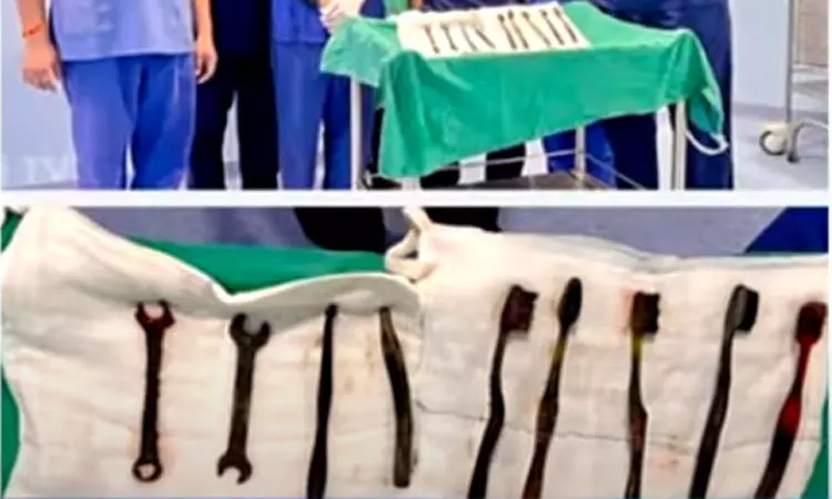 ராஜஸ்தானில் இளைஞரின் வயிற்றில் இருந்து இரும்பு ஸ்பேனர்கள் அகற்றம்